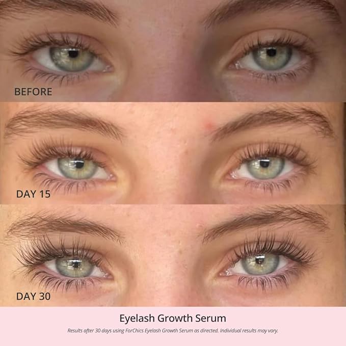 ForChics Lash and Brow Growth Duo - Complete Eye Transformation Kit- Prostaglandin-Free Peptide Formula for Fuller Lashes and Brows in 2 Weeks - Hormone-Free, Vegan (2 x 0.10 fl oz)
