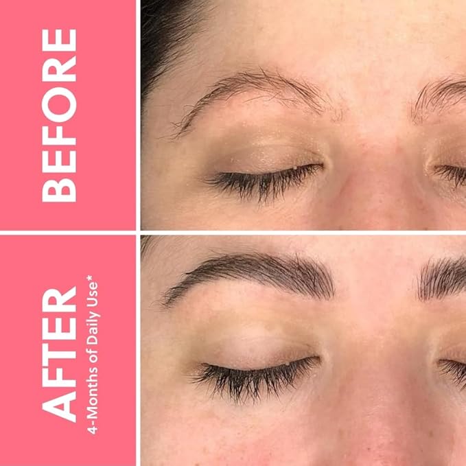 ForChics Lash and Brow Growth Duo - Complete Eye Transformation Kit- Prostaglandin-Free Peptide Formula for Fuller Lashes and Brows in 2 Weeks - Hormone-Free, Vegan (2 x 0.10 fl oz)