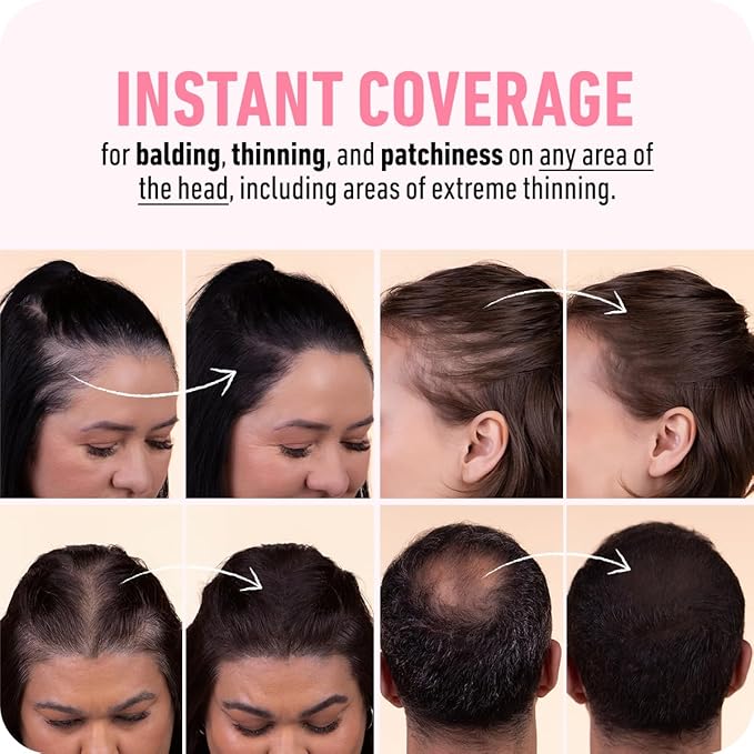 BOLDIFY Hairline Powder (LARGE, 10g) - Root Touch Up Hair Color for Gray Coverage - Bald Spot Concealing Hair Powder for Women & Men - 24-Hour Stain-Proof - Auburn