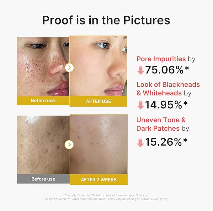 medicube Peel Shot with Turmeric | Reset in One Step | Gentle Exfoliating Serum with BHA, LHA & PHA for Dead Skin Cells, Blackheads & Excess Sebum | For Dull, Rough & Troubled Skin | 2.7 fl.oz